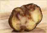 Phytophtora o Blight